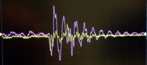 acetylcholine oscilloscope